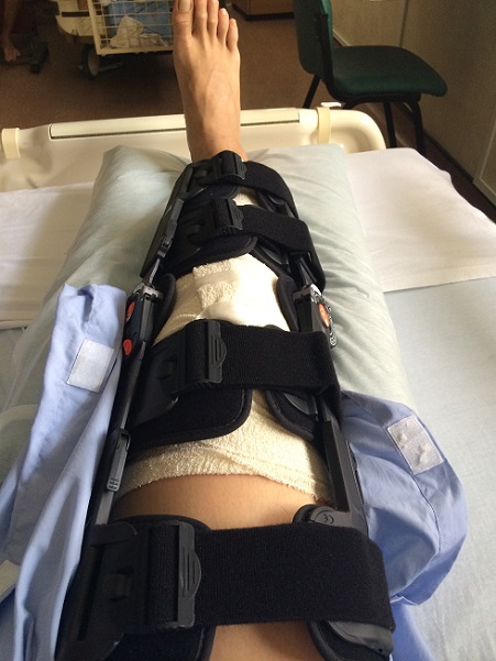 [week 6] Post Acl Reconstruction Surgery Recovery Acl
